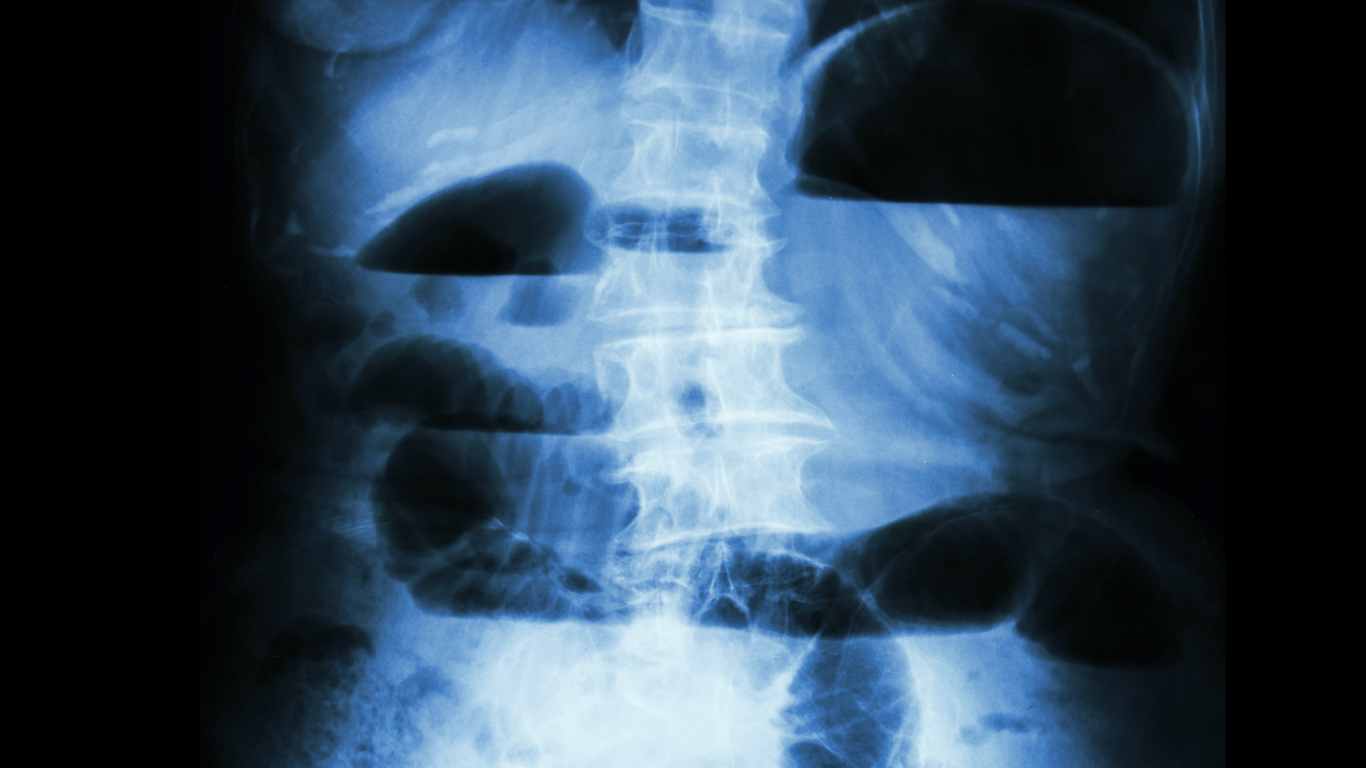 The Science Of The Closed Loop Obstruction